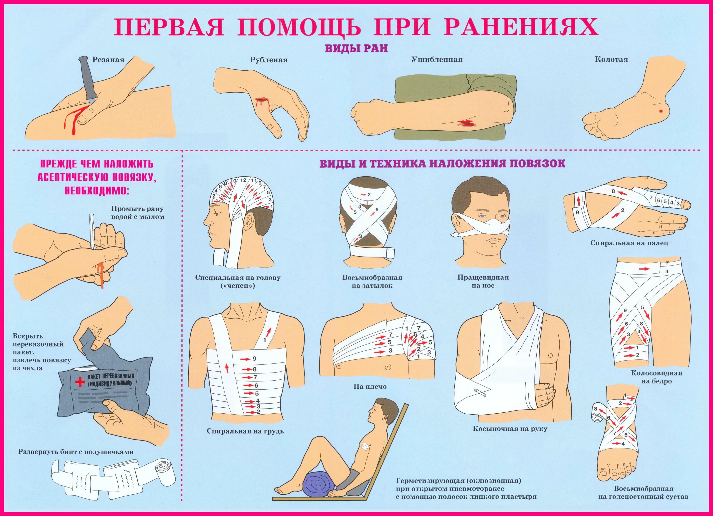 Первая помощь при ранах заключается в