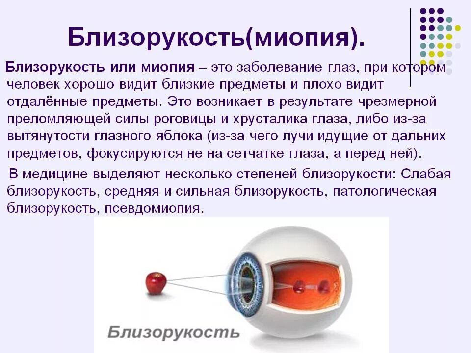 Миопия. Близорукость миопия. Болезнь глаз близорукость. Болезнь дальнозоркость