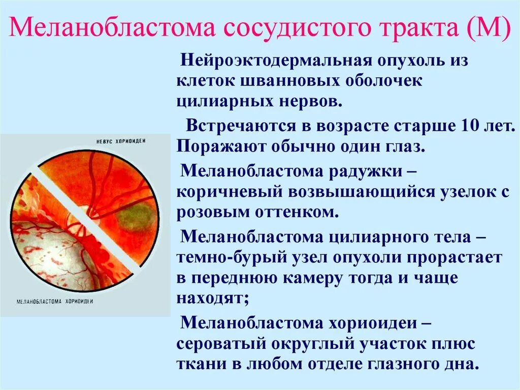 Заболевания сосудистой оболочки. Заболевания сосудистого тракта. Новообразования сосудистого тракта. Новообразования сосудистого тракта глаза. Опухоль сосудистой оболочки.