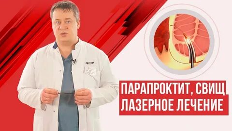 Иссечение свища при парапроктите