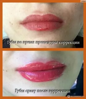 Висячие губы
