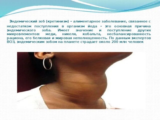 Статистика заболеваний эндокринной системы в россии. Определение понятия эпидемия. Смертность населения. Эпидемиологическая обстановка. Основные причины смертности.