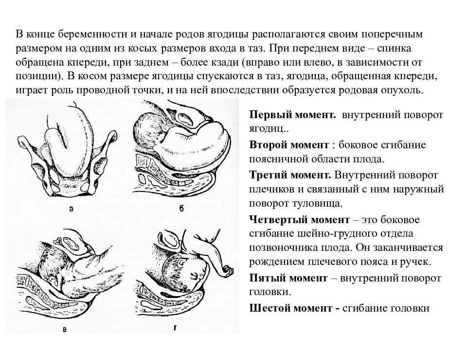 Биомеханизм родов головное предлежание. Акушерское пособие в заднем виде затылочного предлежания. Биомеханизм родов Акушерство. Акушерское пособие при переднем виде.