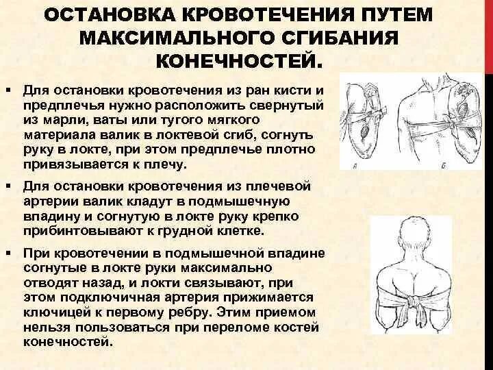 Способы остановки кровотечения на предплечье. Остановка артериального кровотечения в области предплечья. Остановка кровотечения из РАН верхних конечностей.