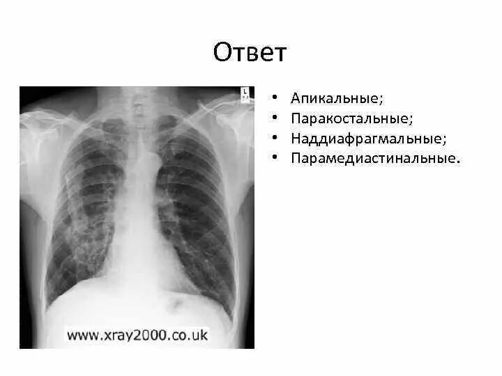 Апикальные спайки