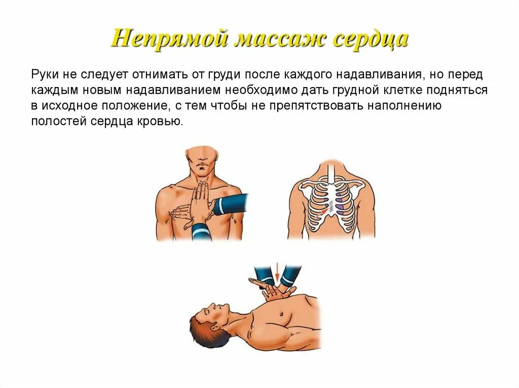 Непрямой массаж сердца первая помощь. Непрямой массаж сердца руки. Первая помощь при непрямом массаже сердца. Непрямой массаж сердца алгоритм.