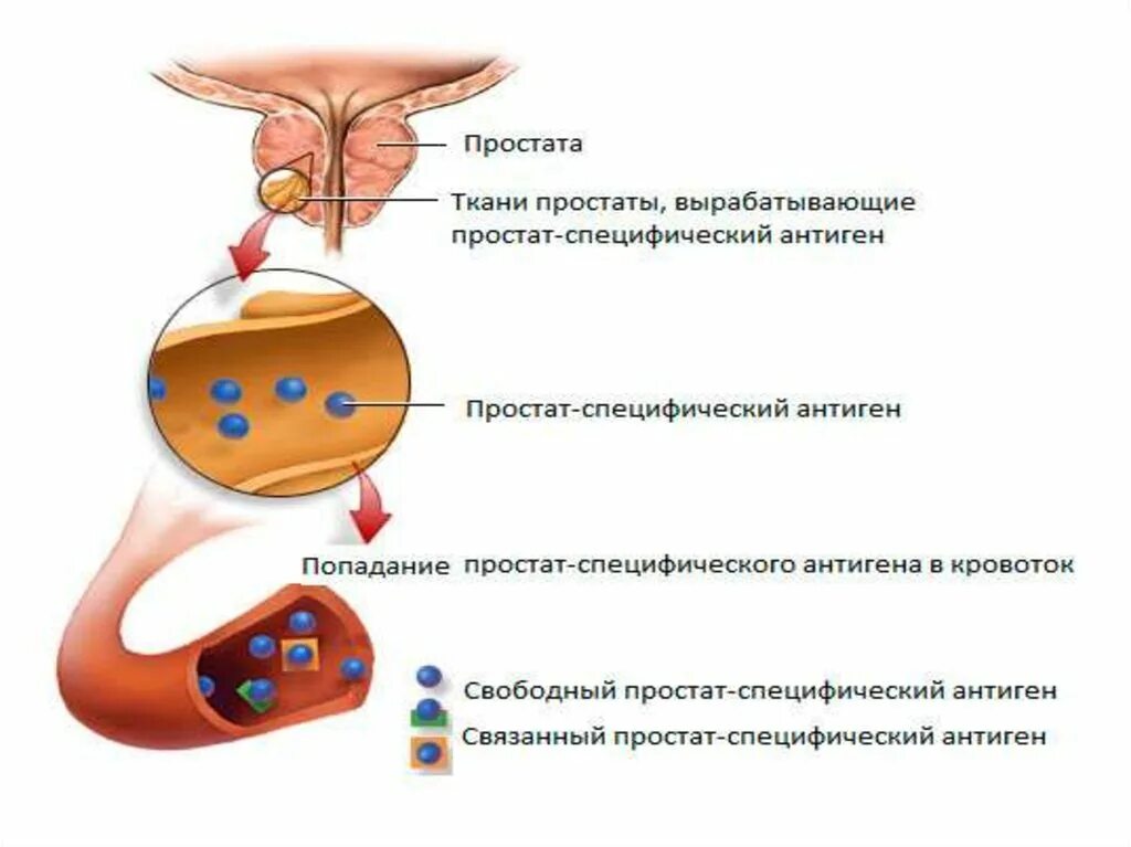 Как снизить пса в крови у мужчин. Простат-специфический антиген (пса). Пса маркер предстательной железы. Простат специфический антиген норма. Простатспецифический антиген что это такое.