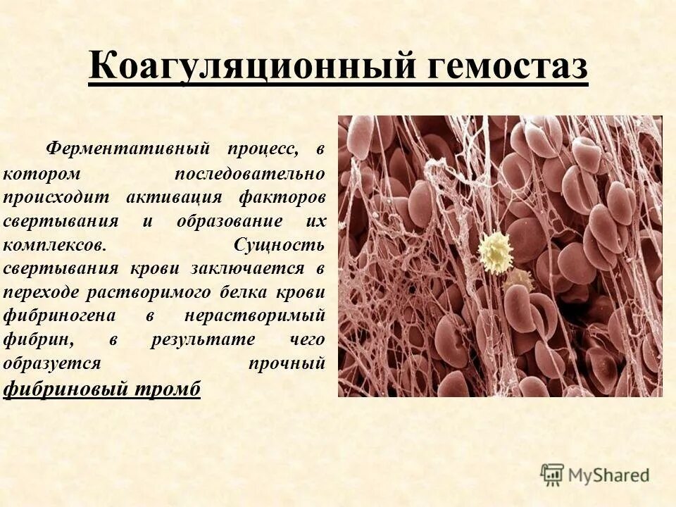 Кдл гемостаз. Фазы коагуляционного гемостаза физиология. первая стадия коагуляционного гемостаза. фазы коагуляционного гомеостаза. механизмы нарушения коагуляционного гемостаза.