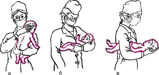 Как правильно держать при подмывании. Подмывание новорожденного девочки алгоритм. Как правильно держать ребенка чтобы подмыть. Как правильно подмывать ребенка. Как подмывать новорожденного.