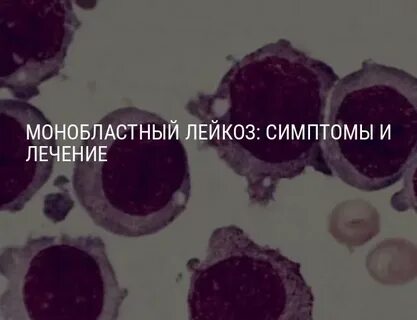 Острый моноцитарный лейкоз