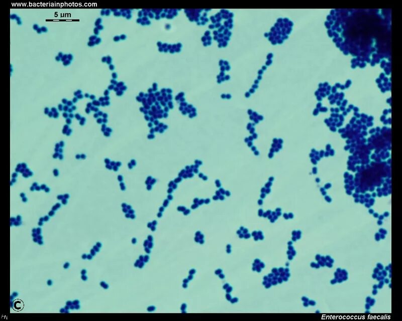 Staphylococcus в мазке у женщин