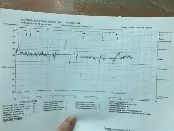 40 недель беременности нет схваток