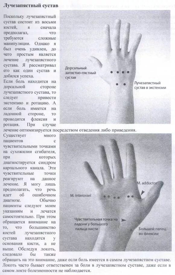 Ноющие боли в кистях рук причины. Боль в лучезапястном суставе. Болит рука в лучезапястном суставе. Болит кисть сустав запястья.