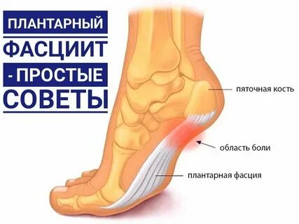 Почему после сна болят ступни ног
