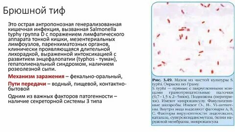 Стул при брюшном тифе