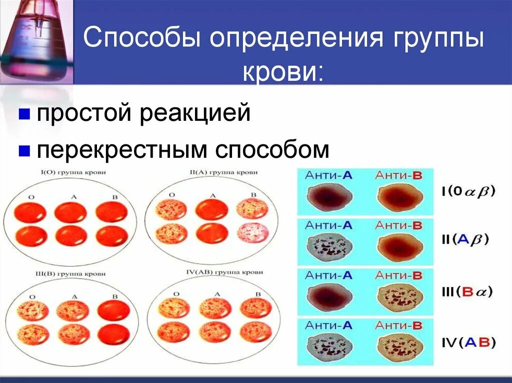 Сывороточный метод определения группы крови. Алгоритм определения крови. Реакция агглютинации для определения группы крови. Клинические методы определения групп крови.