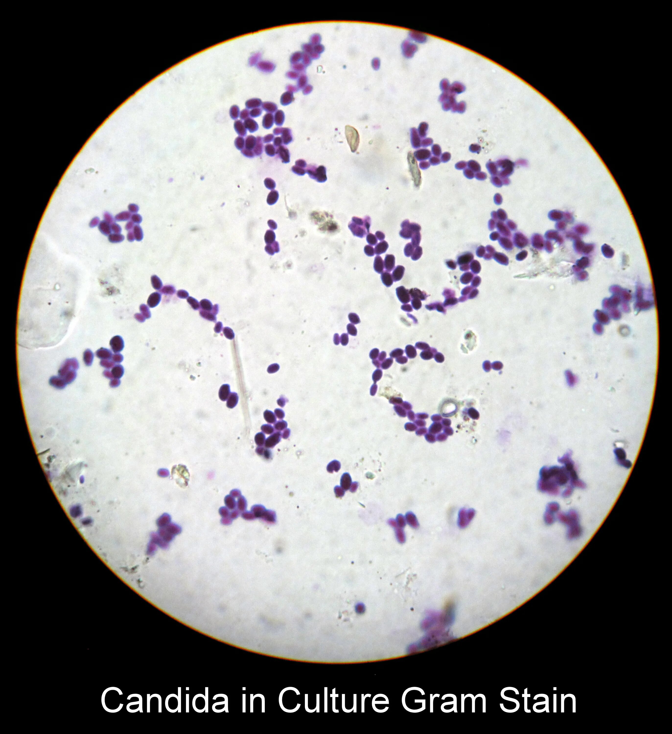 4. Гриб candida у женщин. Кандида альбиканс под микроскопом. Гриб candida у женщин. Грибы кандида микроскопия мазка.