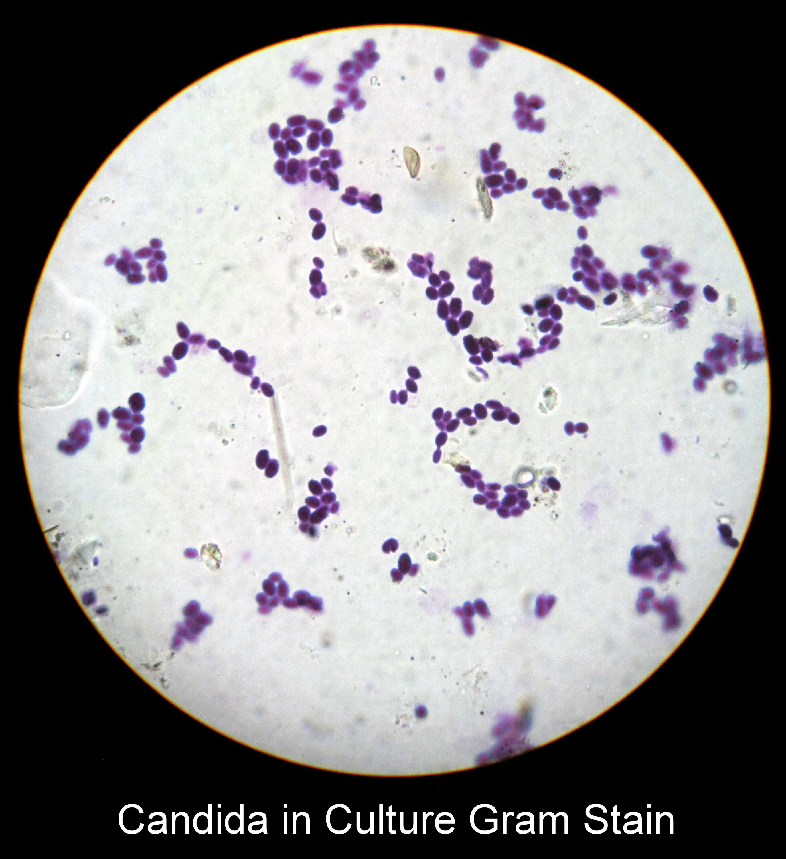 Молочница бактерии. Грибы кандида микроскопия мазка. Кандида альбиканс мазок. Грибы кандида микроскопия. Кандида альбиканс микросоп.