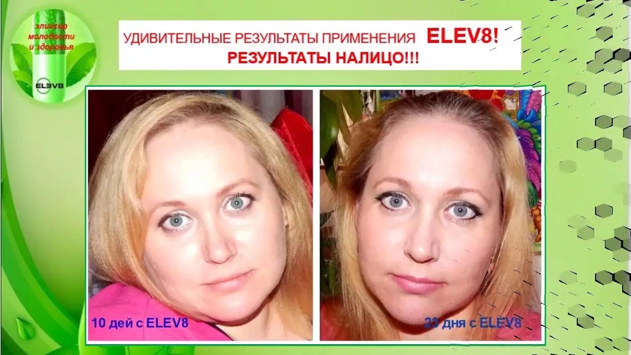 Елев 8. Elev8 Bepic. Elev 8 применение. Elev8 до после. Сегодня лайф результаты