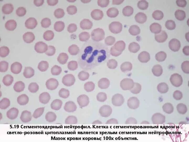 Сегментоядерные у женщин. Сегментоядерные у женщин