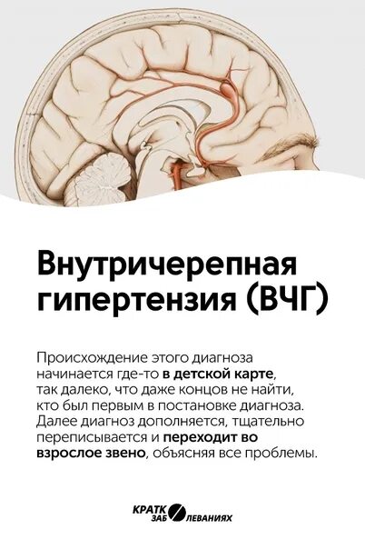 Доброкачественная внутричерепная гипертензия. Внутричерепная гипертензия симптомы. Вгутричерепное гипертензия. Внутричерепная гипертензия классификация.