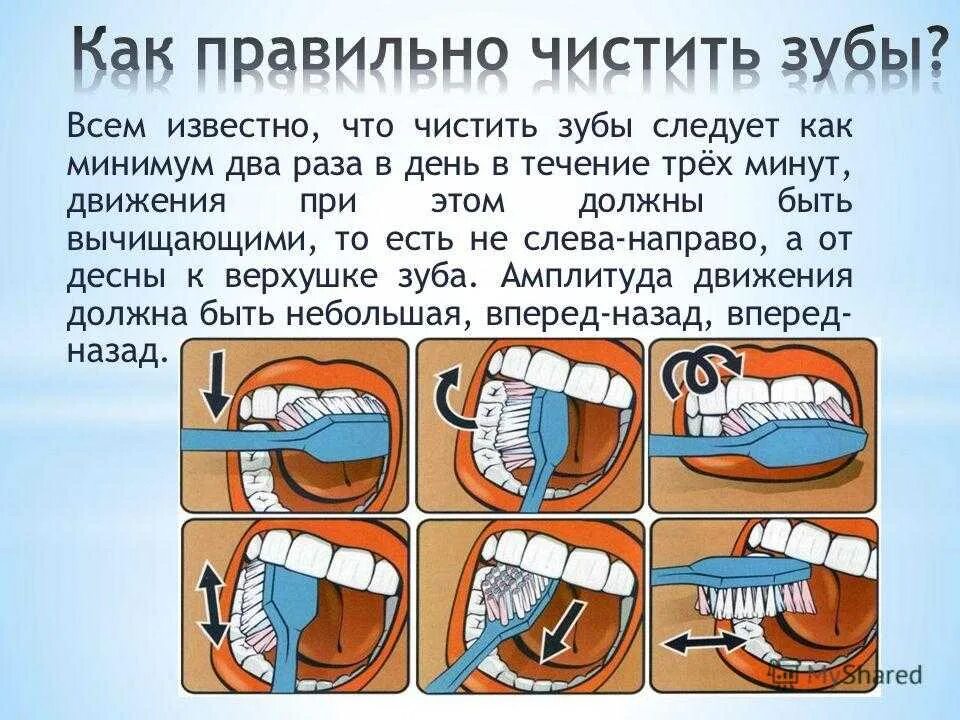 Как правильно чистить зубы. Схема чистки зубов. Схема правильной чистки зубов. Правильная чистка зубов.