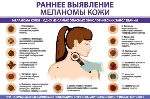 Меланова