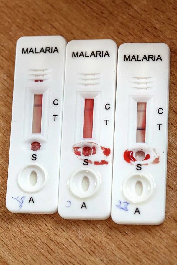 Малярия тестирование. Экспресс тест на малярию. Малярия ИХА. Malaria Rapid Diagnostic Test. Экспресс диагностика малярии.