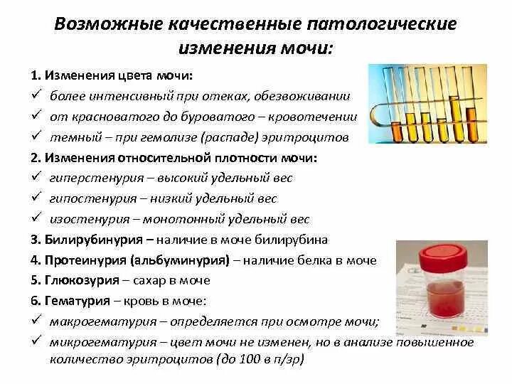 Подтекает моча у мужчин. Изменение цвета мочи. Патологические изменения мочи. Изменение цвета мочи причины. Причины изменения мочи.