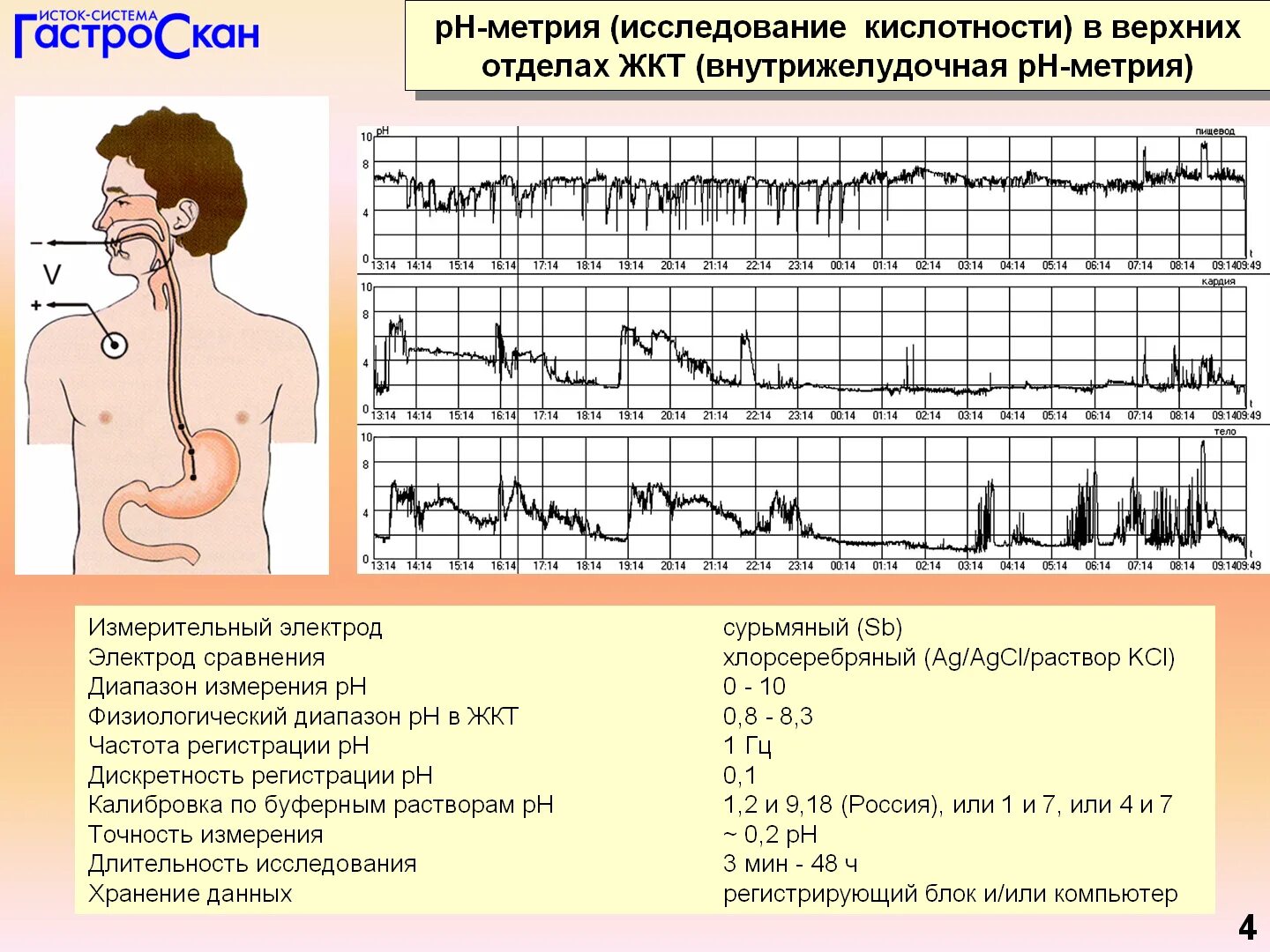 Кислотность пищевода. Внутрижелудочковая РН метрия методика. Внутрижелудочная РН-метрия методика проведения. PH метрическое исследование желудочной секреции. Суточная PH метрия ГЭРБ.