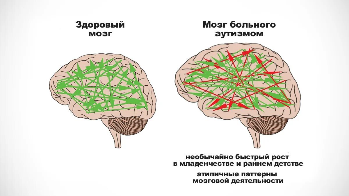 Long brain. Аутизм мозг. История мозга. Autism Neurobiology. Аутистик ехехе.