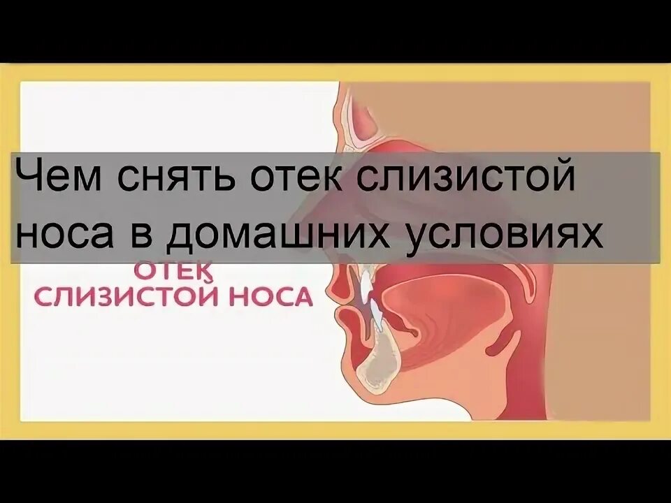 Схема гайморовых пазух. Основные заболевания носа. Лайфхаки от заложенности носа. При заложенности носа у ребенка. Дышать паром при заложенности носа.