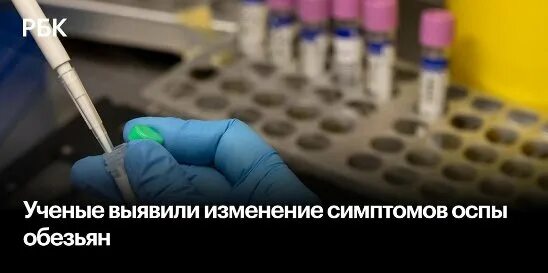 Как заболевают обезьяньей оспой. Как заболевают обезьяньей оспой