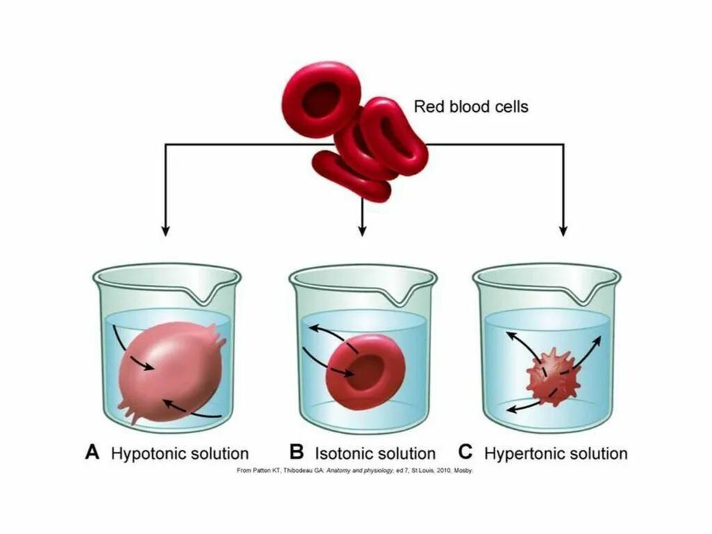 Эритроцит в гипотоническом и гипертоническом растворе. Эритроциты в гипотоническом растворе. Гипотонический изотонический гипертонический раствор эритроциты. Гипотонический раствор эритроциты рисунок.