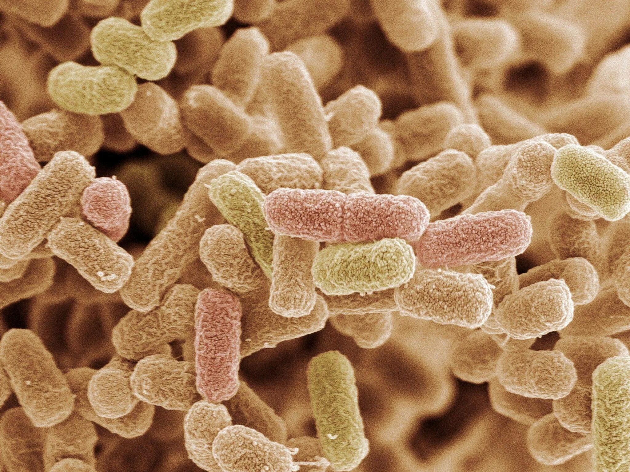 Бактерия Escherichia coli. О микроорганизмы Escherichia coli. Кишечная палочка Escherichia coli. Эшерихия кишечная палочка.
