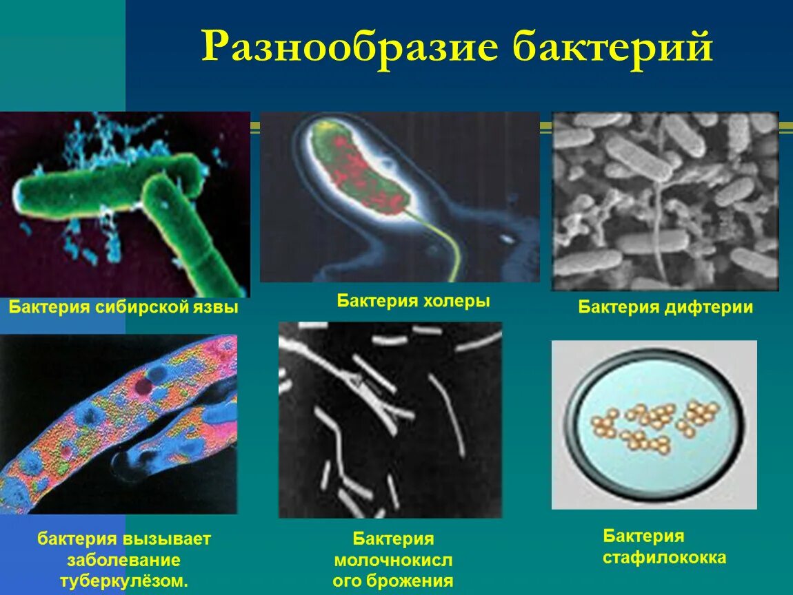 Болезнетворные бактерии биология. Бактерии вызывающие заболевания. Болезнетворные бактерии заболевания. Болезни вызванные болезнетворными бактериями. Болезнетворные бактерии вызывают заболевания.