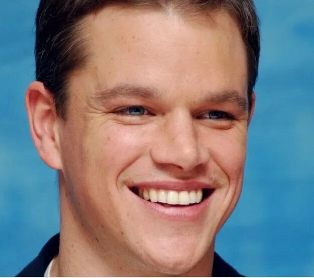 15 celebrities whose faces completely changed when they had their teeth done Met