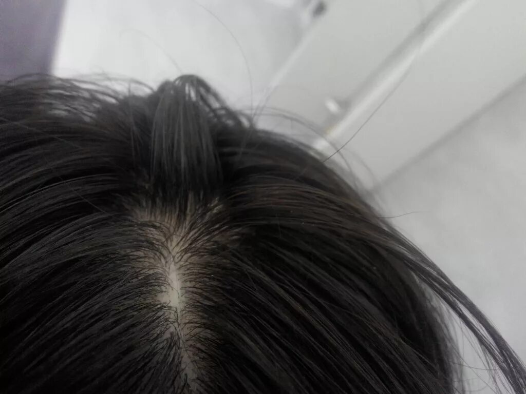 Приснилось что сильно выпадают волосы. К чему снится выпадение волос на голове у женщин.