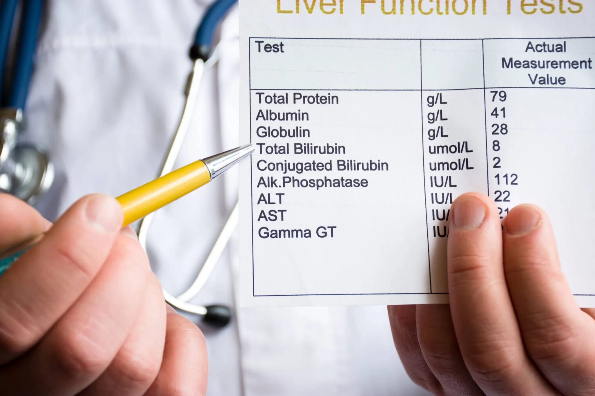 Билирубин спроси врача. Тест на билирубин. bilirubin blood test. liver blood test. blood chemistry test bilirubin direct.