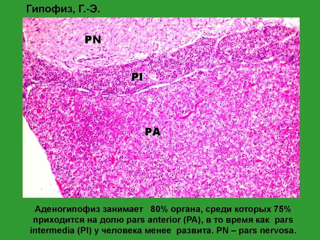 Гипофиз ткань. Нейрогипофиз гистология препарат. Строение аденогипофиза гистология. Гипофиз гистологический препарат.