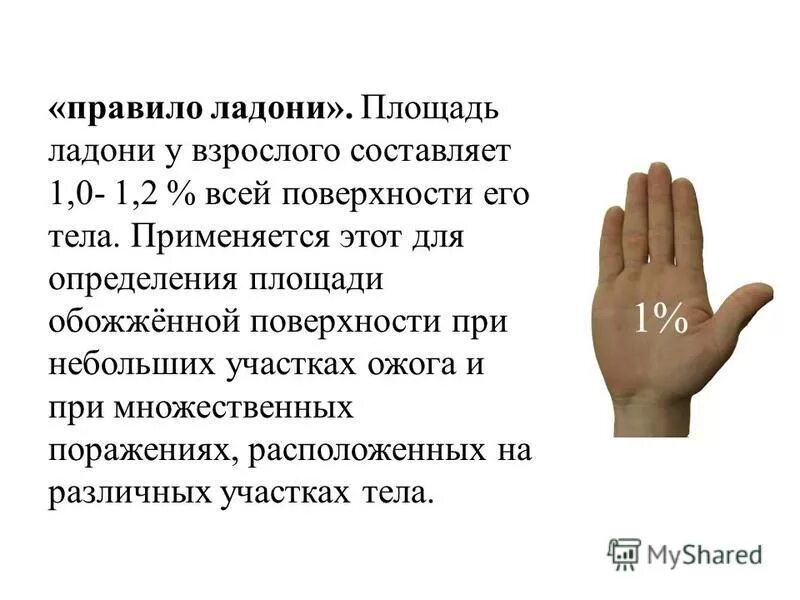 «правило ладони» ( площадь ладони составляет. «правило ладони» ( площадь ладони составляет. Площадь ладони составляет. Площадь ладони взрослого человека см. Площадь ладошки.