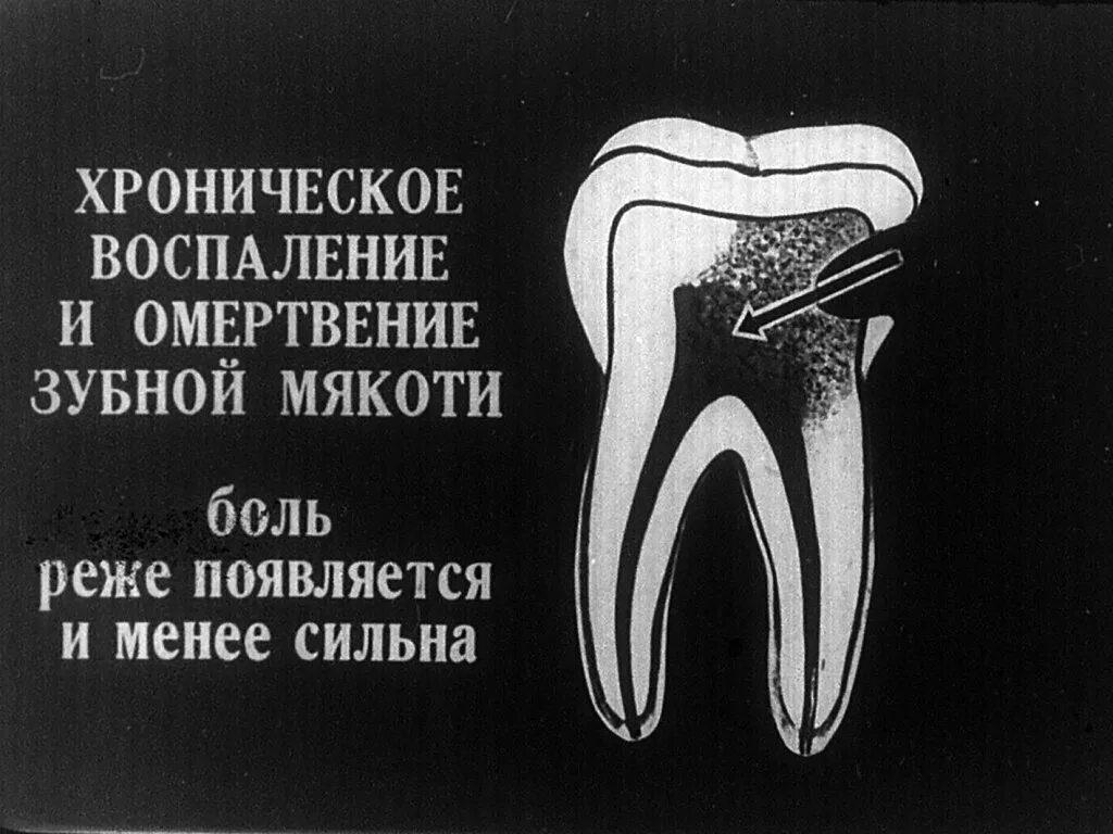 Редко появляется. Редко появляется