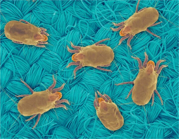 Dust mite allergies in the house