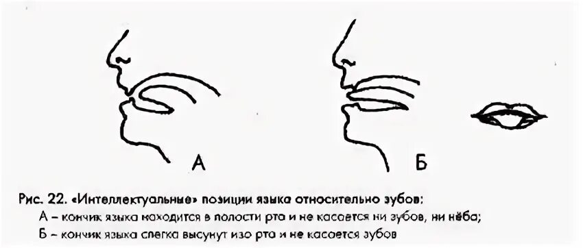 Как держать язык во рту. Правильное положение языка. Положение языка в ротовой полости.