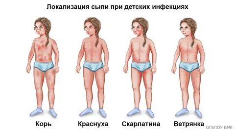 После прививки краснухи можно купаться