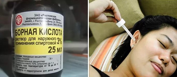 Борная кислота закапывание в ухо. Капли в уши на спирту. Борная кислота капли для ушей. Борная кислота применяется для:. Кислота в ухо при отите.