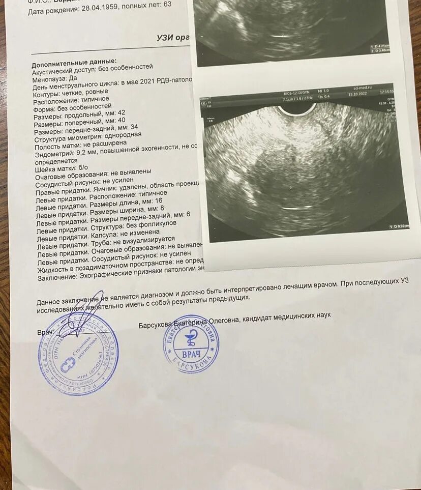Узи малого таза можно ли при месячных. Расшифровка узи малого таза. расшифровка узи малого таза у женщин. норма эндометрия при узи малого таза. узи малого таза у женщин норма.