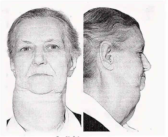Едпей. Едпей