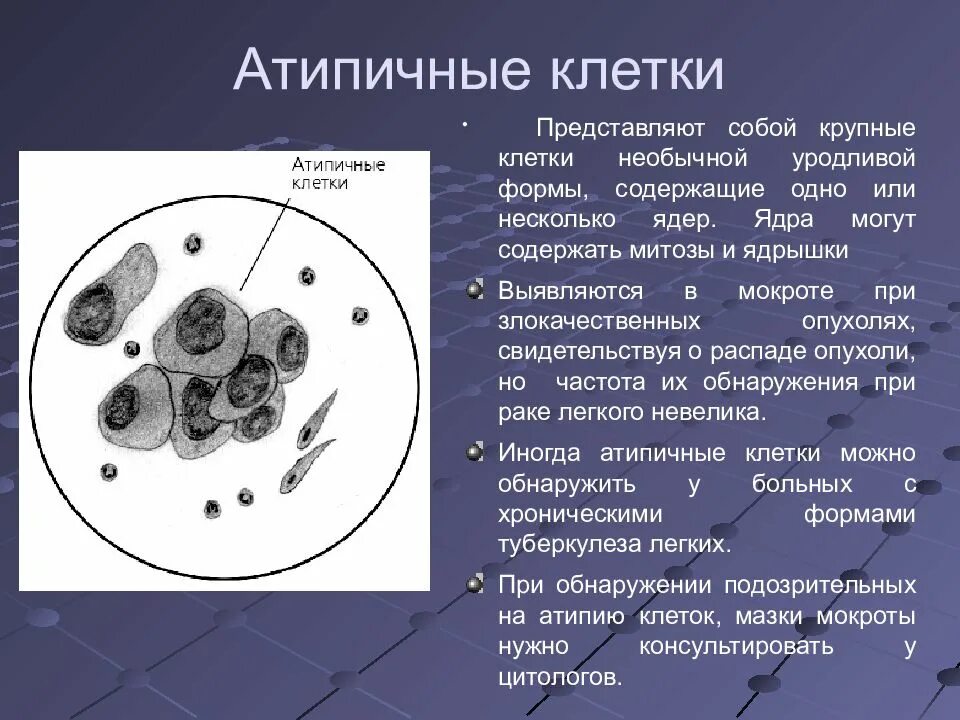 В мокроте можно обнаружить. Мокрота атипичные клетки исследование мокроты. Исследование на атипичные клетки. Цитологическое исследование на атипические клетки. Мазок мокроты на атипичные клетки.