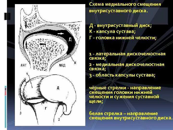 Дислокации дисков. Дислокации дисков